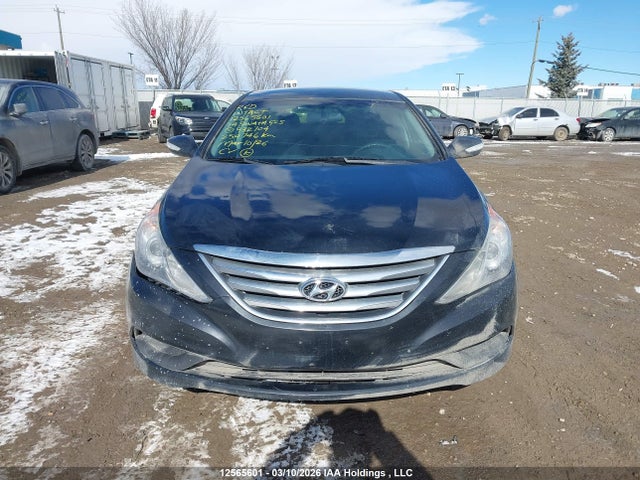 12565601 :رقم المزاد ، 5NPEB4AC1EH932704 vin ، 2014 Hyundai Sonata Gls مزاد بيع