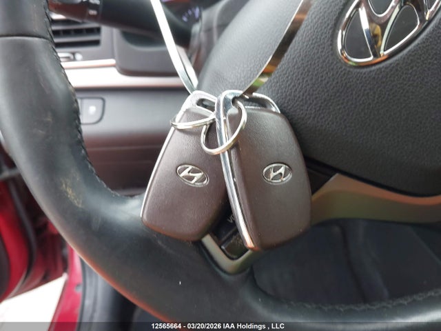 KMHD84LFXHU249519 Hyundai Elantra Se/value/limited