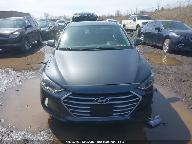 KMHD84LF2HU186481 Hyundai ELANTRA GL