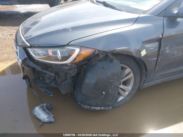 KMHD84LF2HU186481 Hyundai ELANTRA GL
