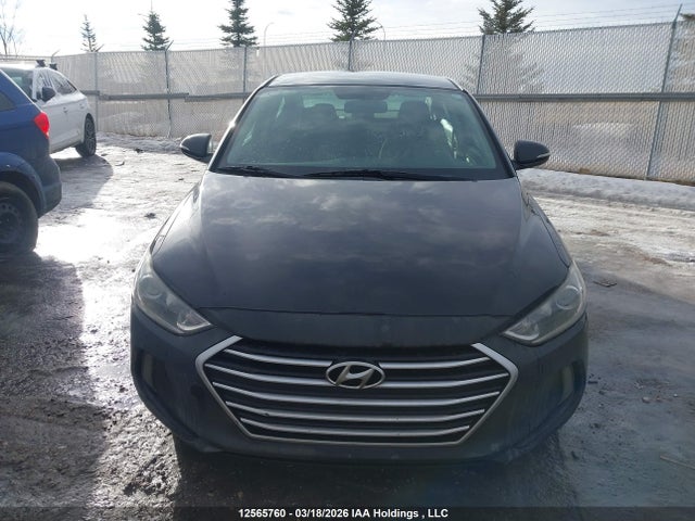 KMHD84LF1HU243950 Hyundai Elantra Se/value/limited