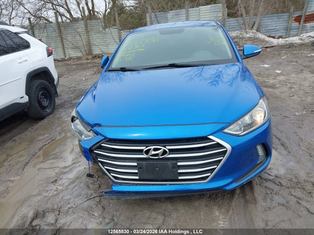 KMHD84LFXHU114363 Hyundai ELANTRA GL