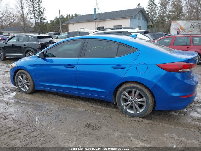KMHD84LFXHU114363 Hyundai ELANTRA GL