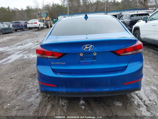 KMHD84LFXHU114363 Hyundai ELANTRA GL