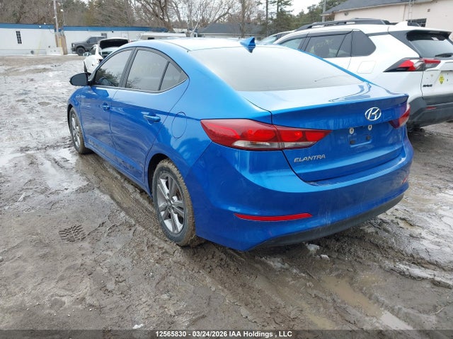 KMHD84LFXHU114363 Hyundai ELANTRA GL