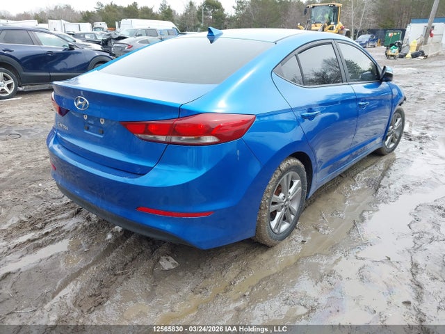 KMHD84LFXHU114363 Hyundai ELANTRA GL