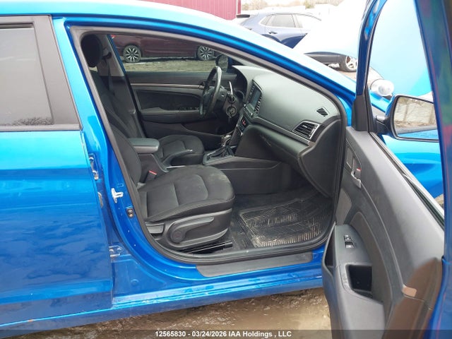 KMHD84LFXHU114363 Hyundai ELANTRA GL
