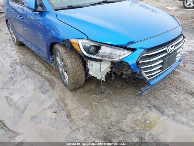 KMHD84LFXHU114363 Hyundai ELANTRA GL