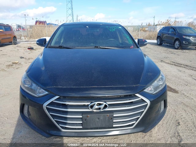 KMHD84LF9JU635130 Hyundai Elantra