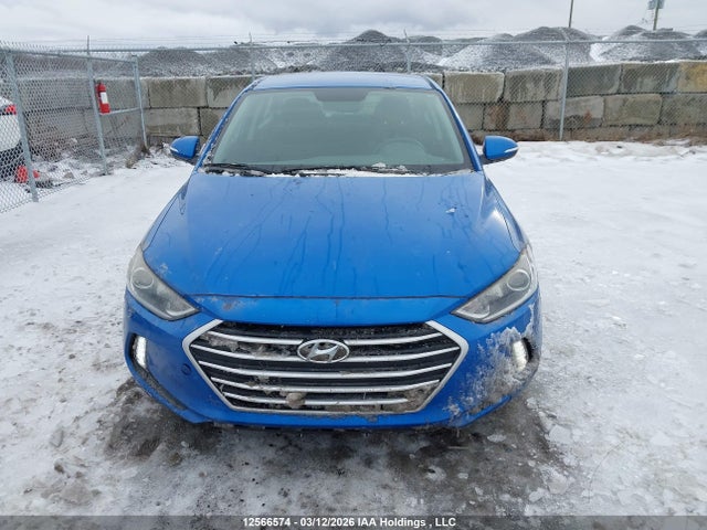 KMHD84LF7JU494459 Hyundai Elantra Sel/value/limited