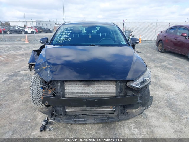 KMHD84LF6HU175189 Hyundai Elantra Se/value/limited