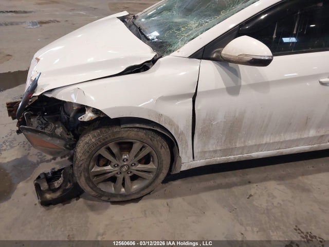 KMHD84LF2HU169535 Hyundai ELANTRA GL
