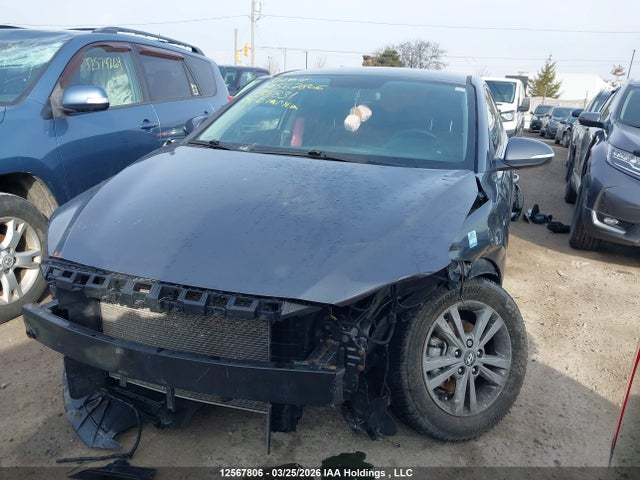 KMHD84LF1JU715831 Hyundai Elantra