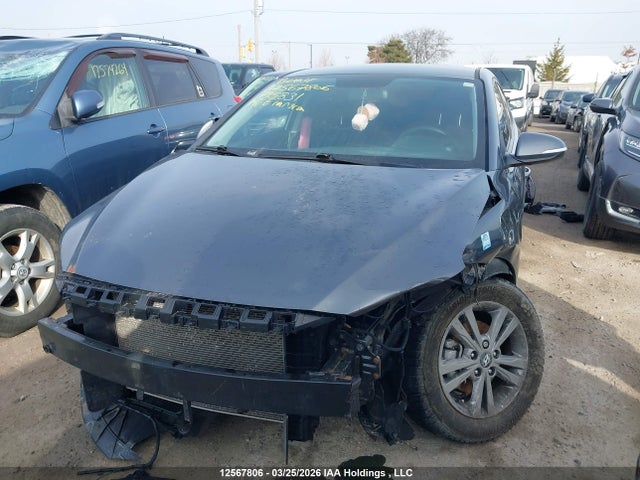KMHD84LF1JU715831 Hyundai Elantra