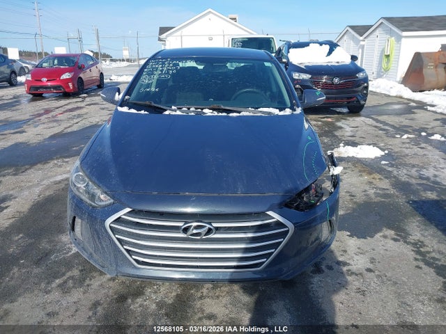 KMHD84LF8HU221136 Hyundai ELANTRA GL
