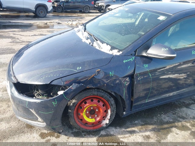 KMHD84LF8HU221136 Hyundai ELANTRA GL