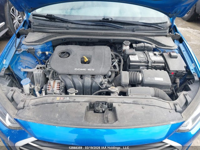 KMHD84LF7HU174472 Hyundai ELANTRA GL
