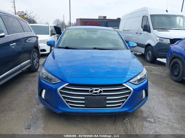 KMHD84LF7HU174472 Hyundai ELANTRA GL