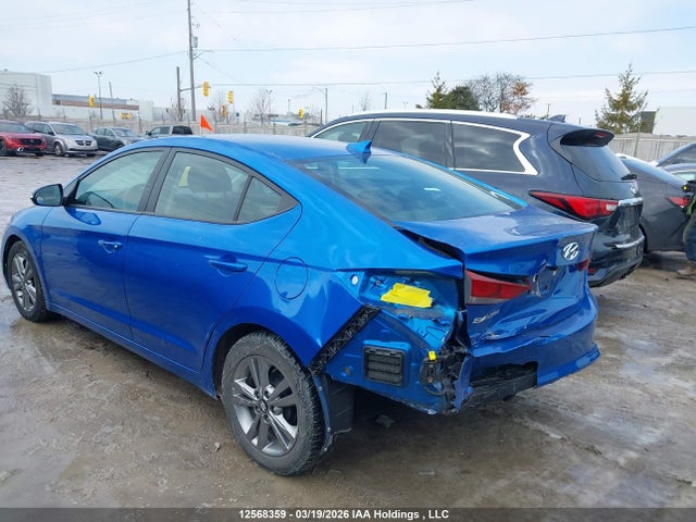 KMHD84LF7HU174472 Hyundai ELANTRA GL