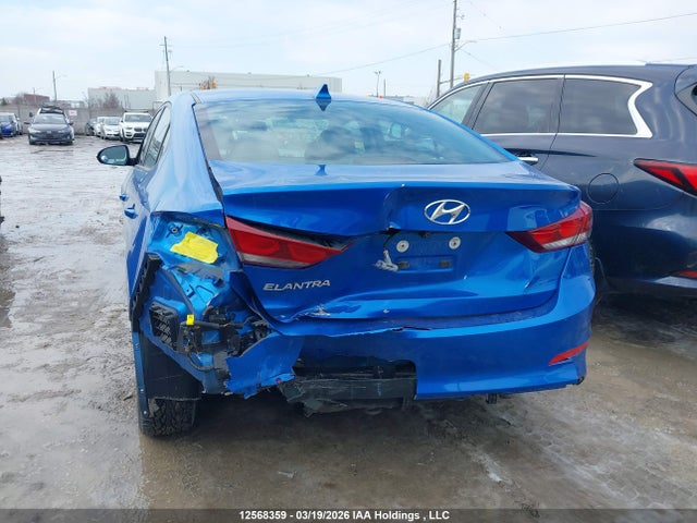 KMHD84LF7HU174472 Hyundai ELANTRA GL