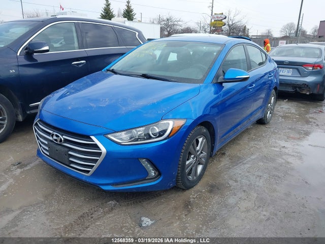 KMHD84LF7HU174472 Hyundai ELANTRA GL