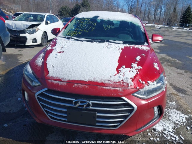 KMHD84LF3JU712199 Hyundai Elantra