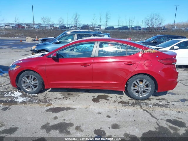 KMHD84LF3JU712199 Hyundai Elantra