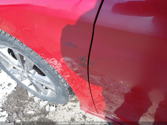KMHD84LF3JU712199 Hyundai Elantra