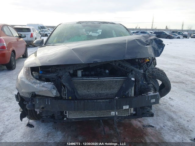 KMHLM4AG1MU097076 Hyundai Elantra