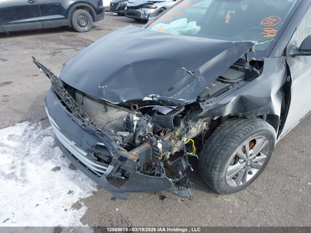 KMHD84LF9HU403072 Hyundai Elantra Se/value/limited
