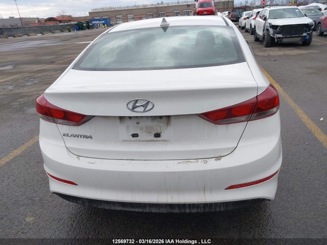 KMHD84LF5HU345638 Hyundai ELANTRA GL