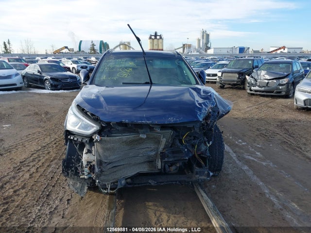 5XYZUDLB7HG482763 Hyundai Santa Fe Sport 2.4 Luxury
