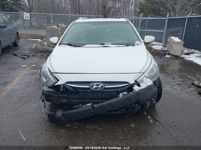 KMHCT5AE2HU329701 Hyundai Accent