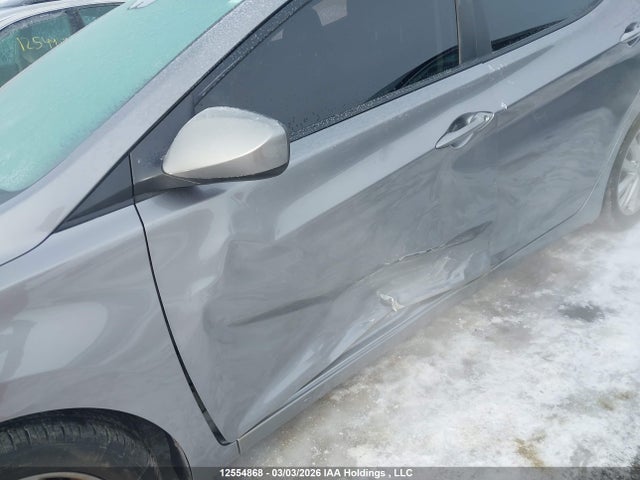 KMHDH4AE9FU309037 Hyundai Elantra Sport Appearance