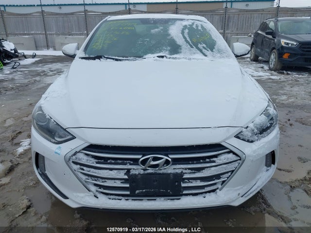 KMHD84LF2JU537685 Hyundai Elantra Sel/value/limited