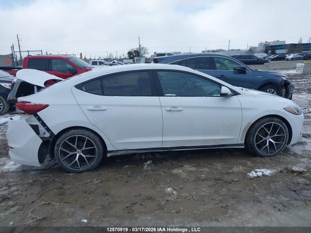 KMHD84LF2JU537685 Hyundai Elantra Sel/value/limited