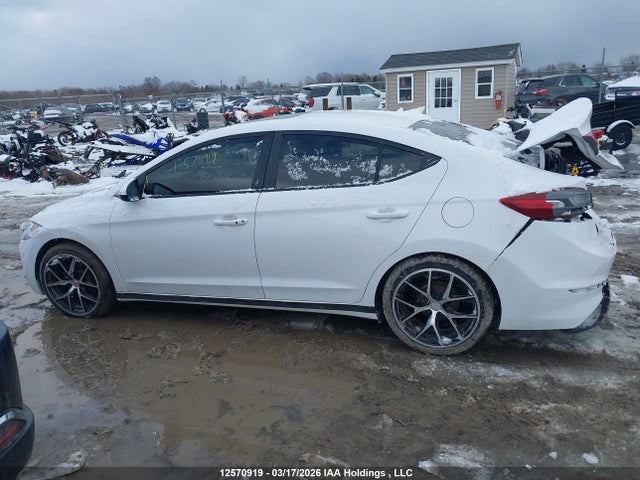 KMHD84LF2JU537685 Hyundai Elantra Sel/value/limited