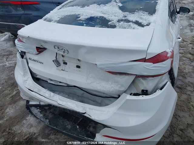 KMHD84LF2JU537685 Hyundai Elantra Sel/value/limited