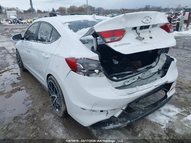 KMHD84LF2JU537685 Hyundai Elantra Sel/value/limited