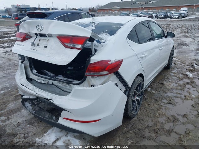 KMHD84LF2JU537685 Hyundai Elantra Sel/value/limited