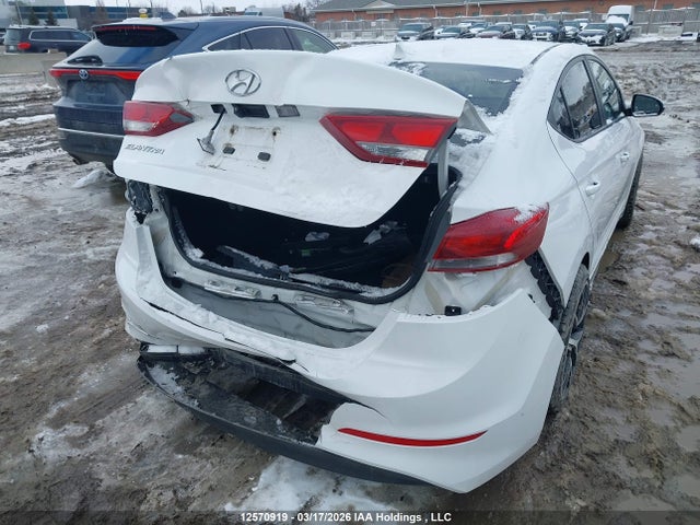 KMHD84LF2JU537685 Hyundai Elantra Sel/value/limited