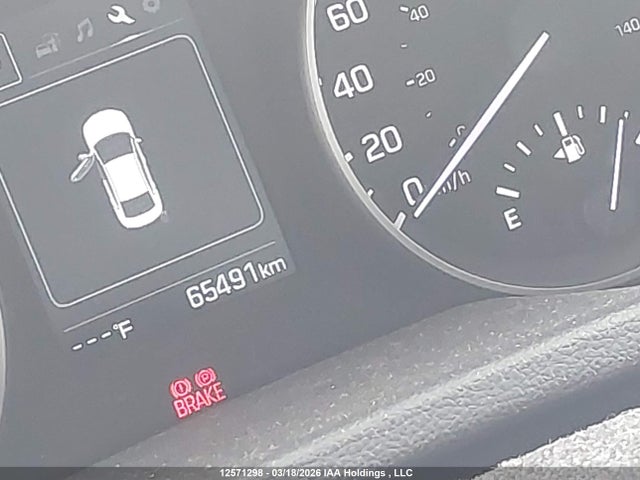 KMHD84LF0JU642709 Hyundai Elantra Sel/value/limited