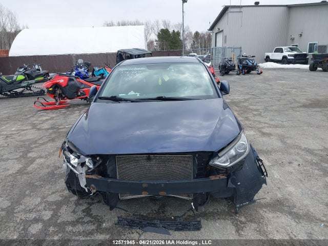 KMHD84LF1HU336225 Hyundai ELANTRA GL