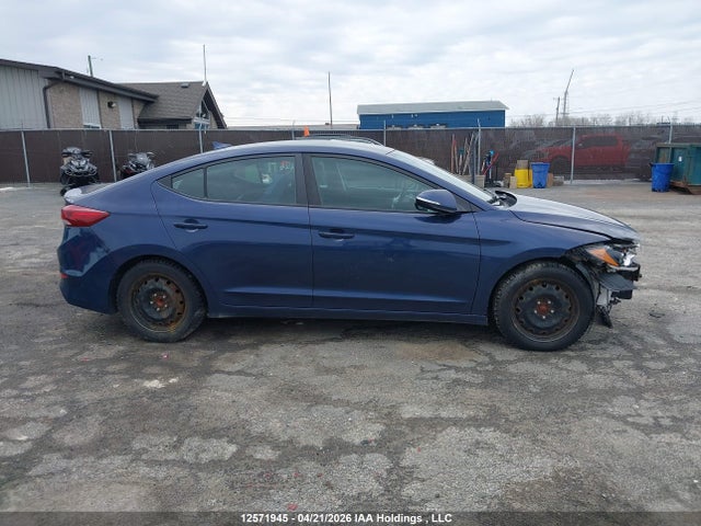 KMHD84LF1HU336225 Hyundai ELANTRA GL