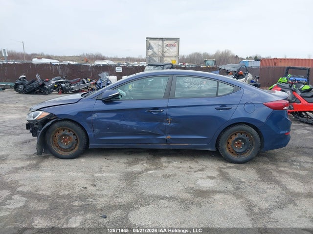 KMHD84LF1HU336225 Hyundai ELANTRA GL