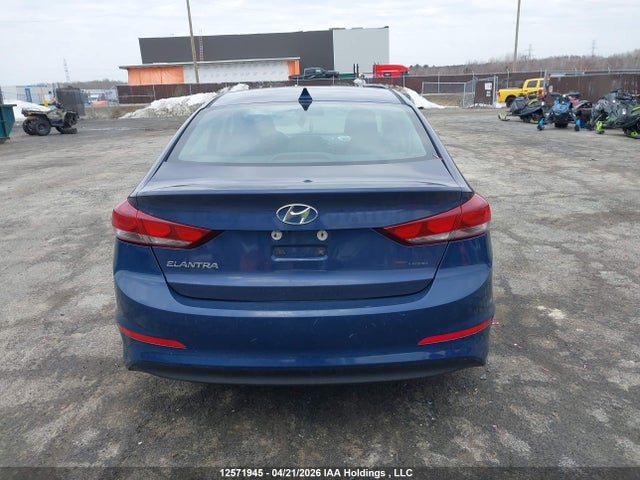 KMHD84LF1HU336225 Hyundai ELANTRA GL