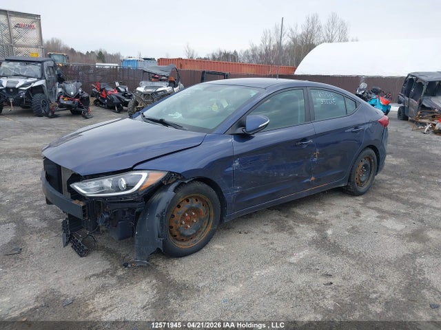 KMHD84LF1HU336225 Hyundai ELANTRA GL