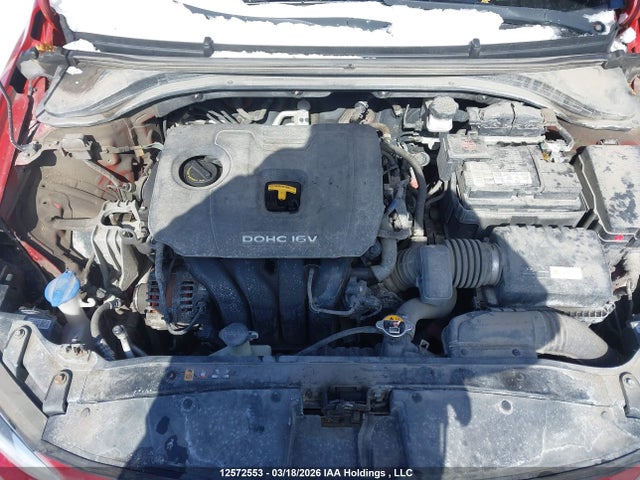 KMHD84LF5JU598576 Hyundai ELANTRA GL