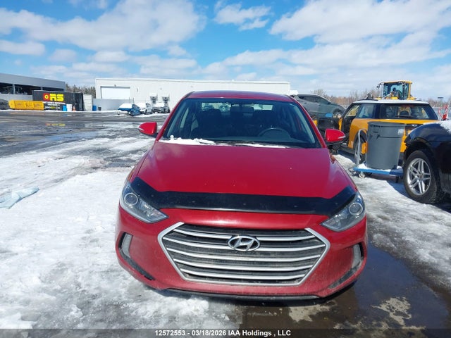 KMHD84LF5JU598576 Hyundai ELANTRA GL