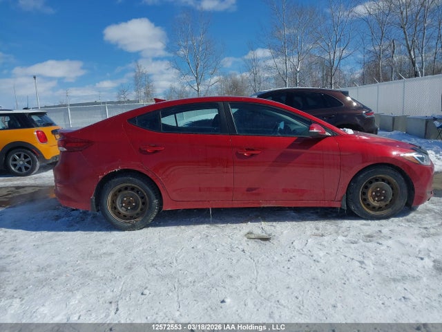 KMHD84LF5JU598576 Hyundai ELANTRA GL